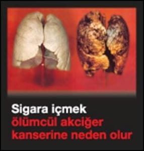 Turkey 2009 Lung Cancer warning